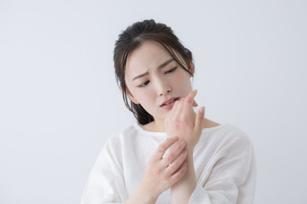 ポリベビーはアトピーにあまりおすすめできない